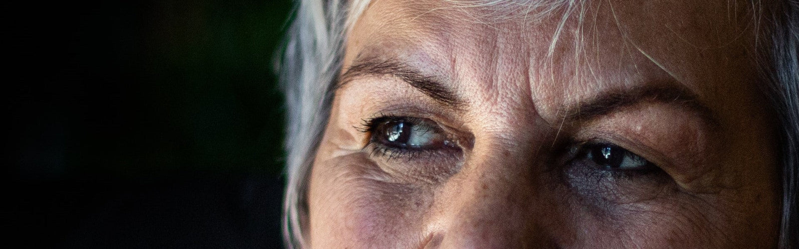 Spätdemenz und Alzheimer