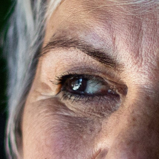 Late-stage dementia and Alzheimer's